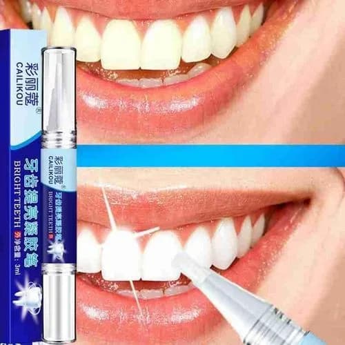 Professional Teeth Whitening Pen